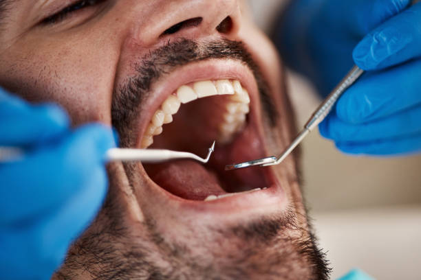 Best Emergency Treatment for Dental Infections or Abscesses in Clyde, NY